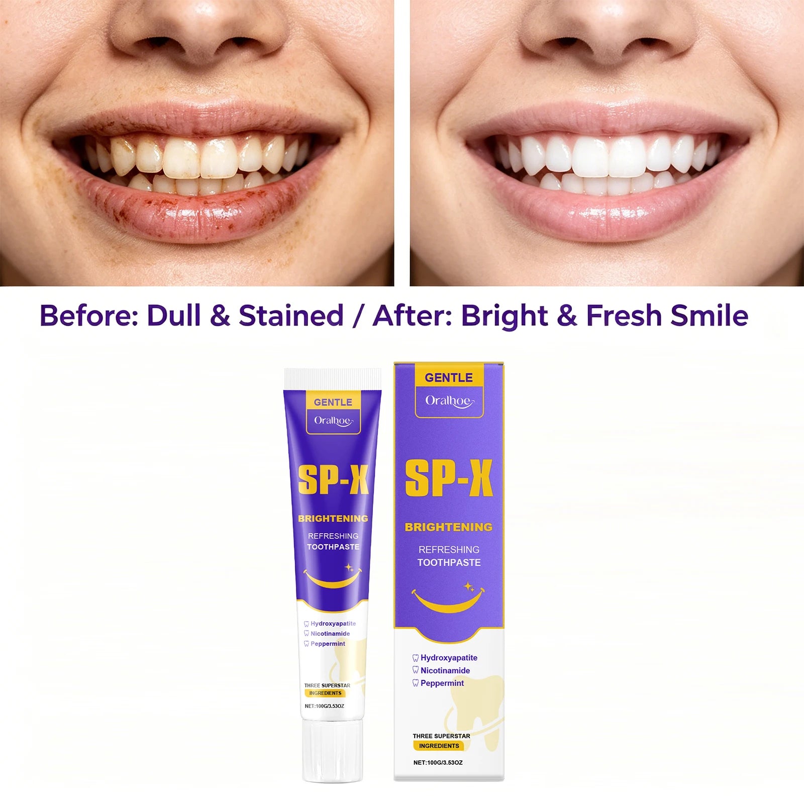 Brightening Toothpaste Teeth Whitening Stain Remover - 3