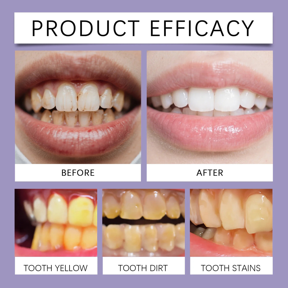 Bee Venom Toothpaste Gum Care and Teeth Whitening Oral Hygiene Cleaner