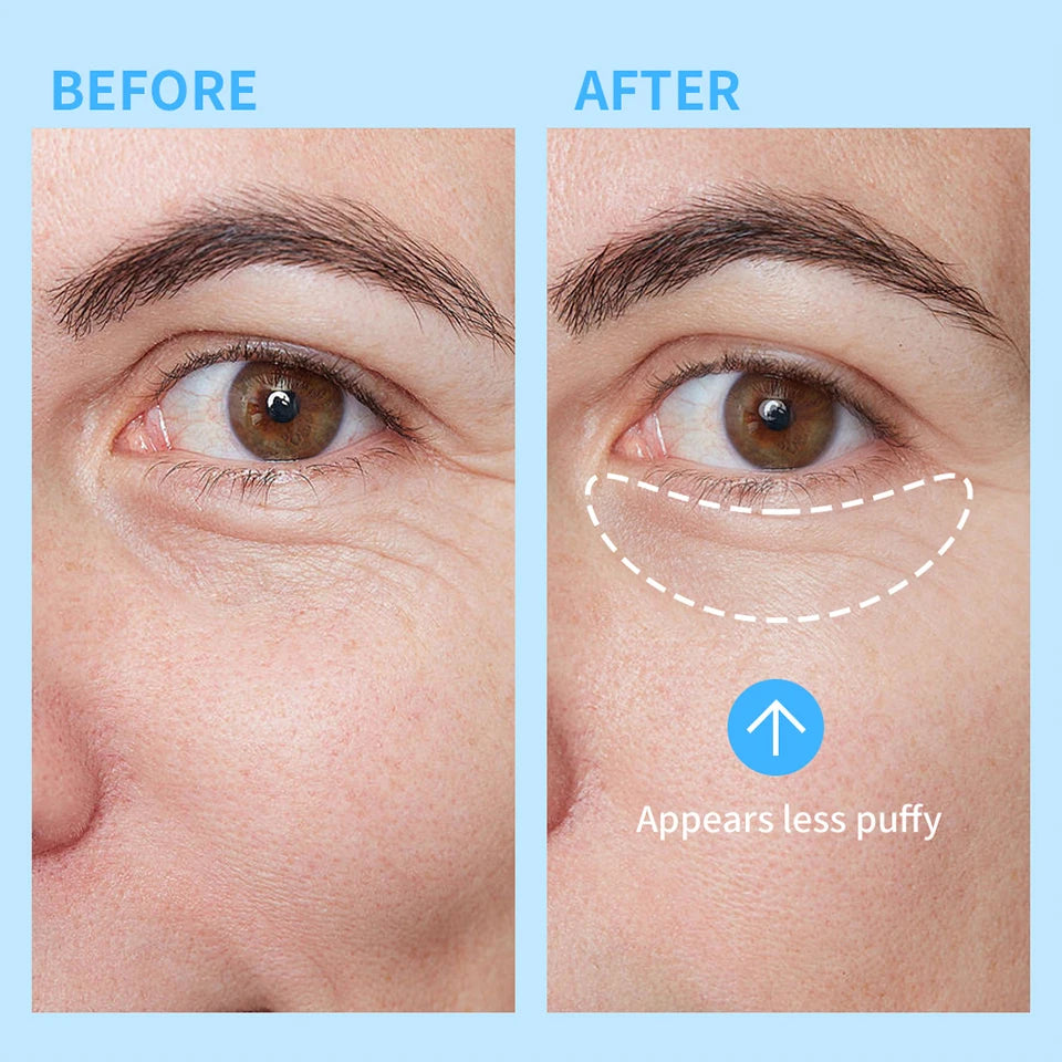 Cooling Eye Gel Hydrating Serum for Dark Circles and Puffiness - 11