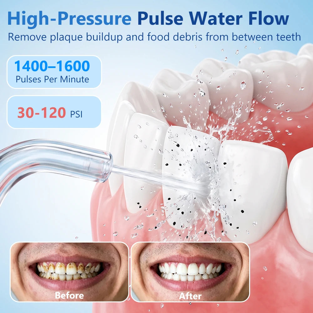 Water Dental Flosser Cordless Oral Irrigator for Teeth Cleaning