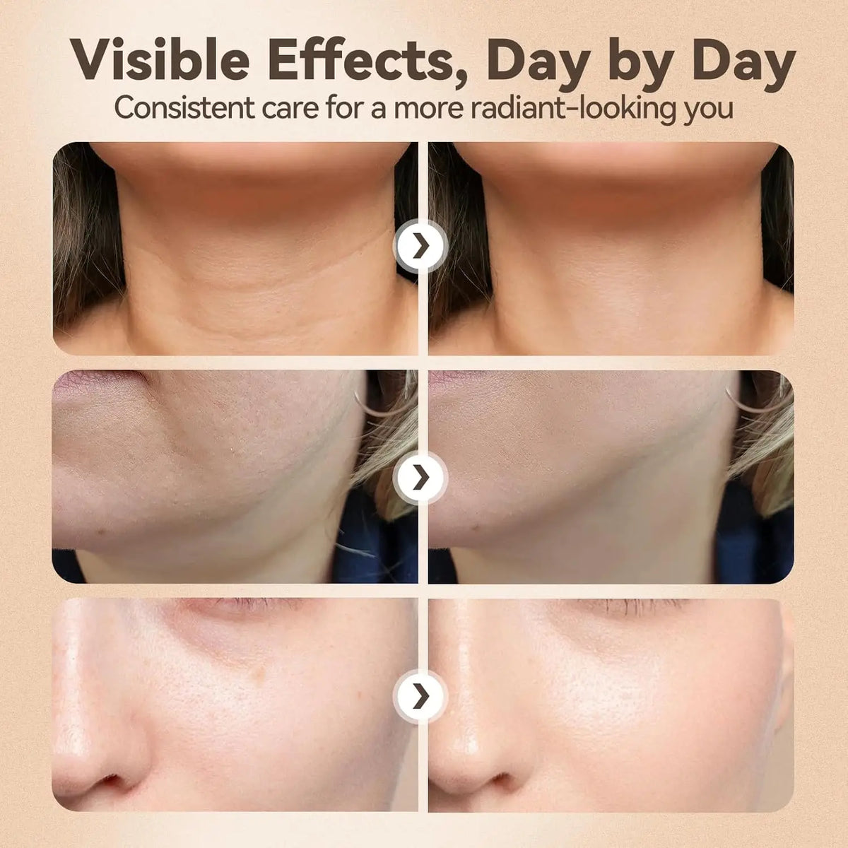 3 in 1 Facial Massager and LED Skin Tightening Device