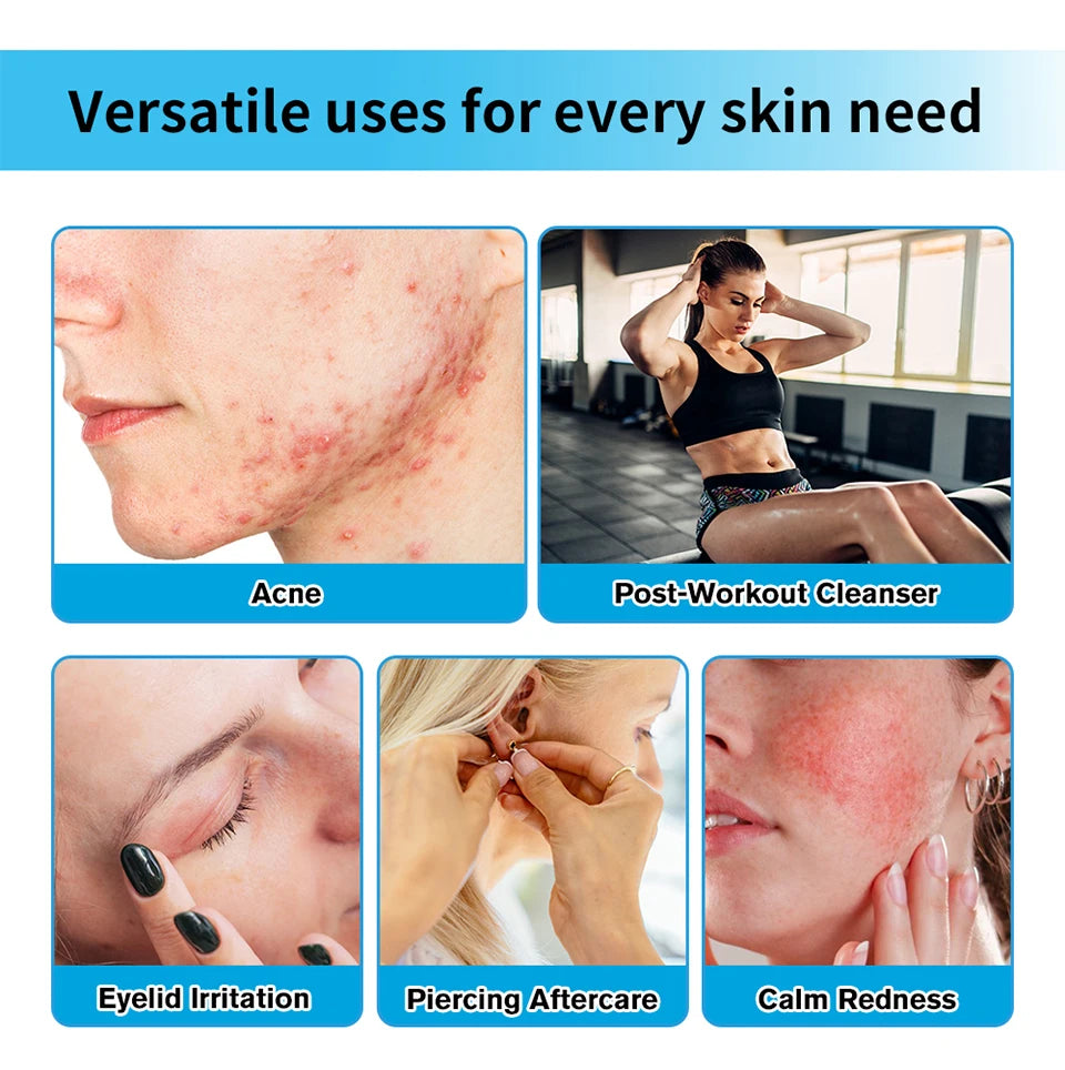Hypochlorous Acid Facial Spray Skin Toner for Acne and Redness - 8