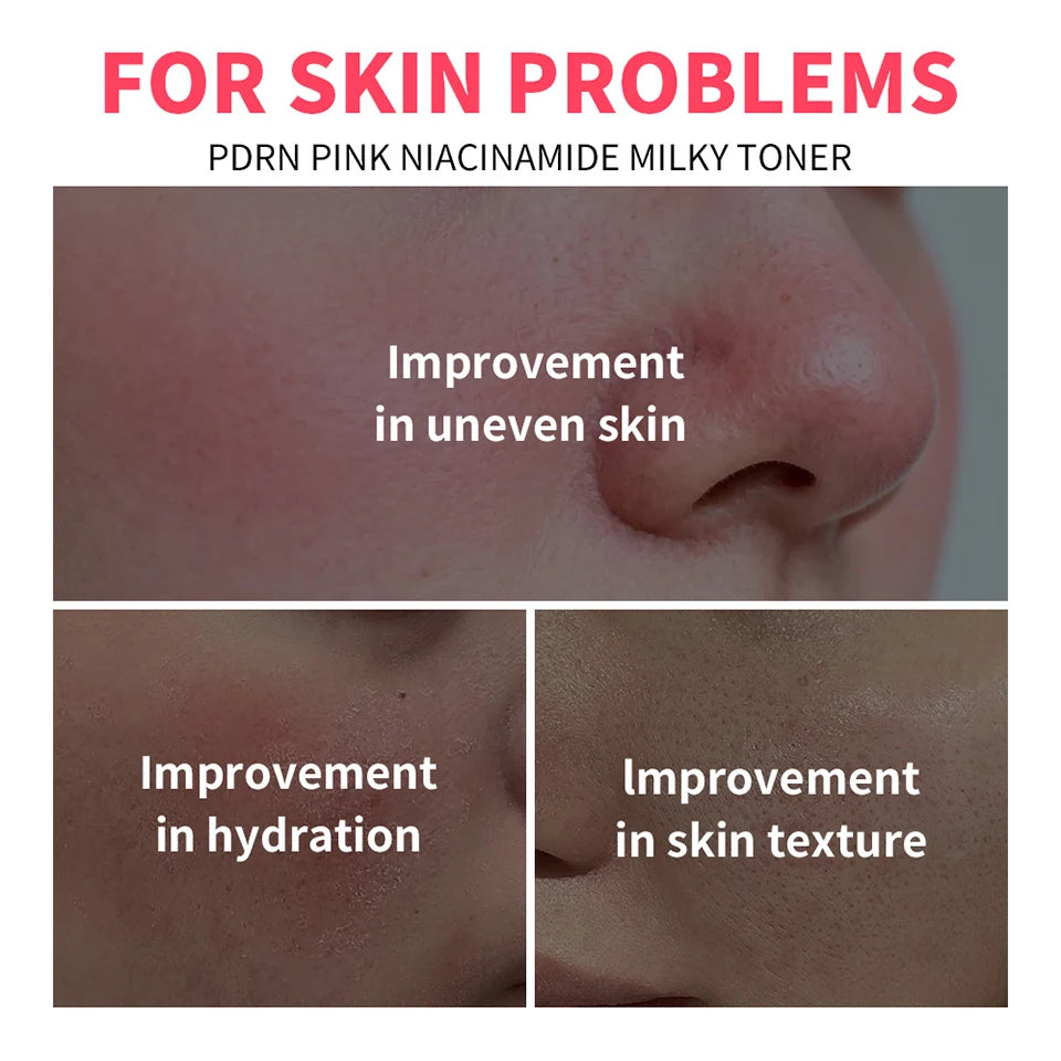 PDRN Niacinamide Toner Pink Milky Facial Lotion for Glowing Skin - 8