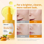 Kojic Acid Turmeric Serum Face Brightening Essence