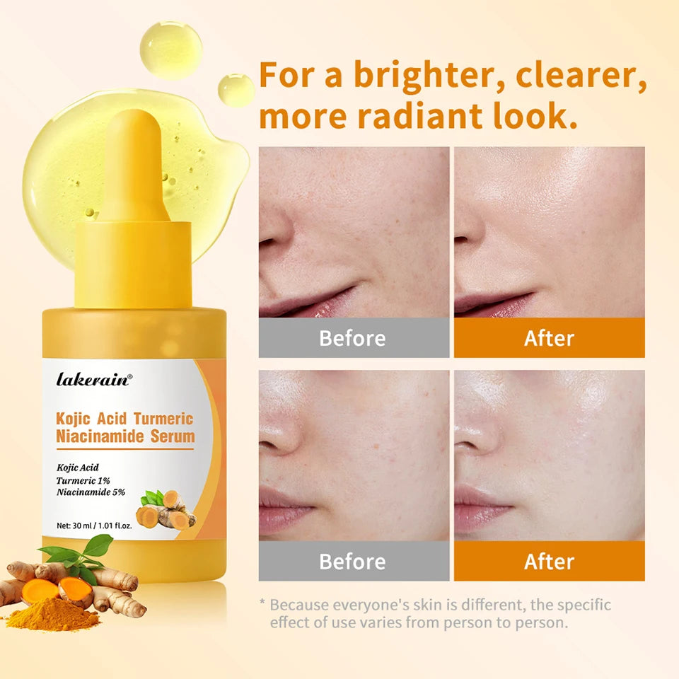 Kojic Acid Turmeric Serum Face Brightening Essence