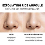 Rice Exfoliating Essence Face Peeling Serum for Brightening Skin