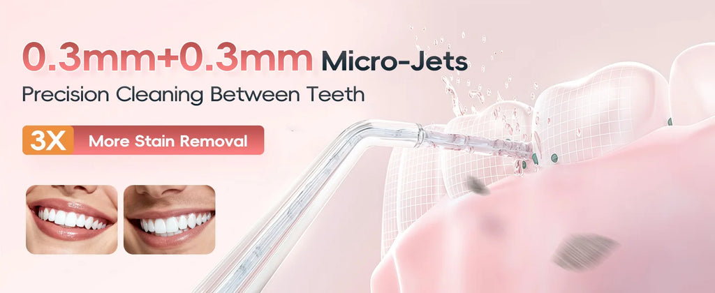 Portable Water Flosser Electric Oral Irrigator Teeth Cleaner