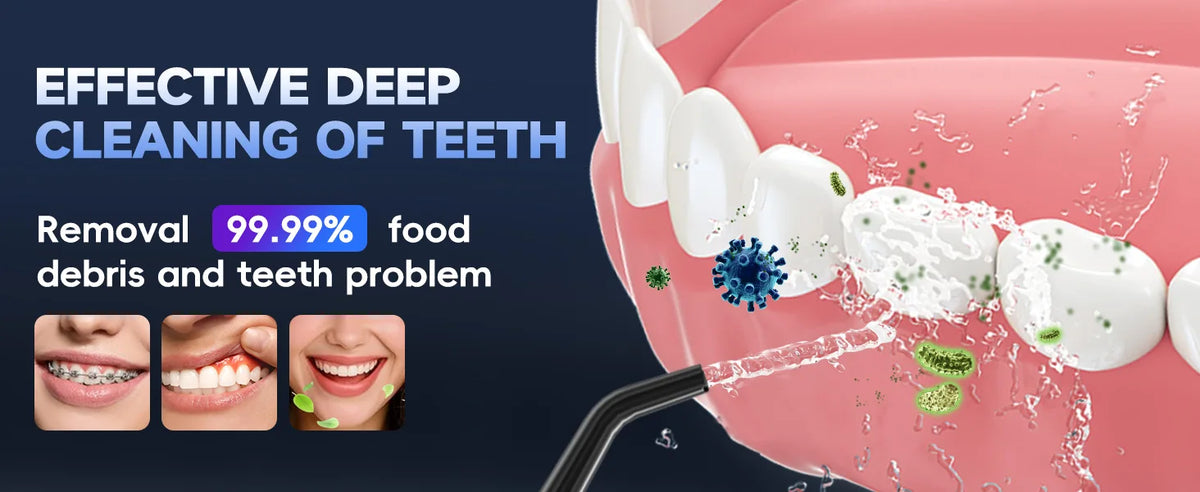 Portable Water Flosser Cordless Dental Oral Irrigator
