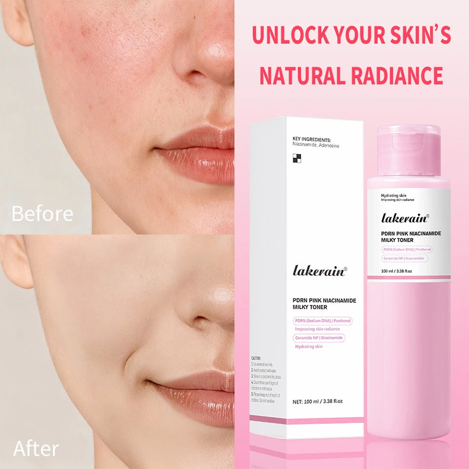 PDRN Niacinamide Toner Pink Milky Facial Moisturizer - 10