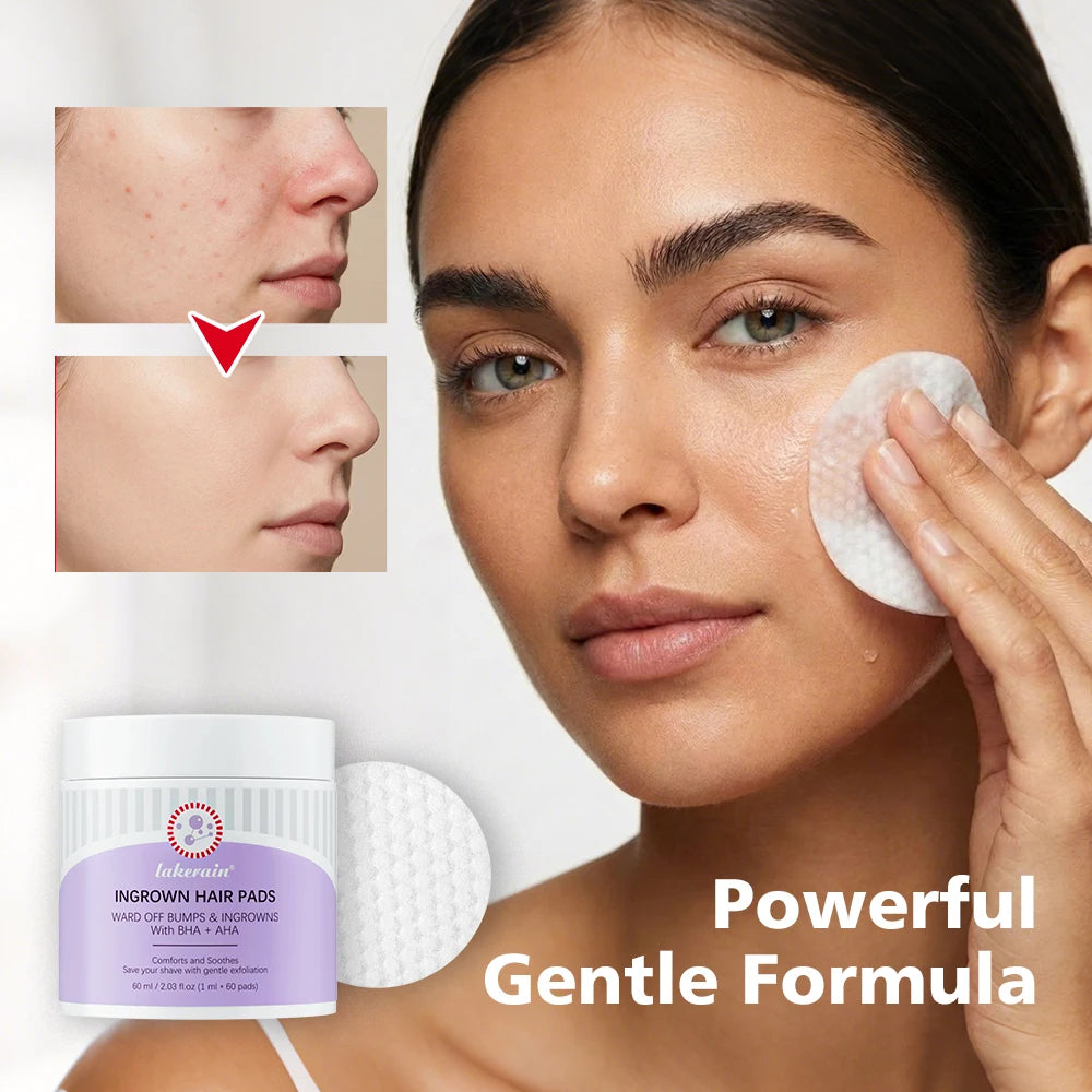 Ingrown Hair Pads and Razor Bump Treatment Exfoliating Wipes