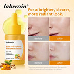 Kojic Acid Turmeric Niacinamide Serum Brightening Face Essence