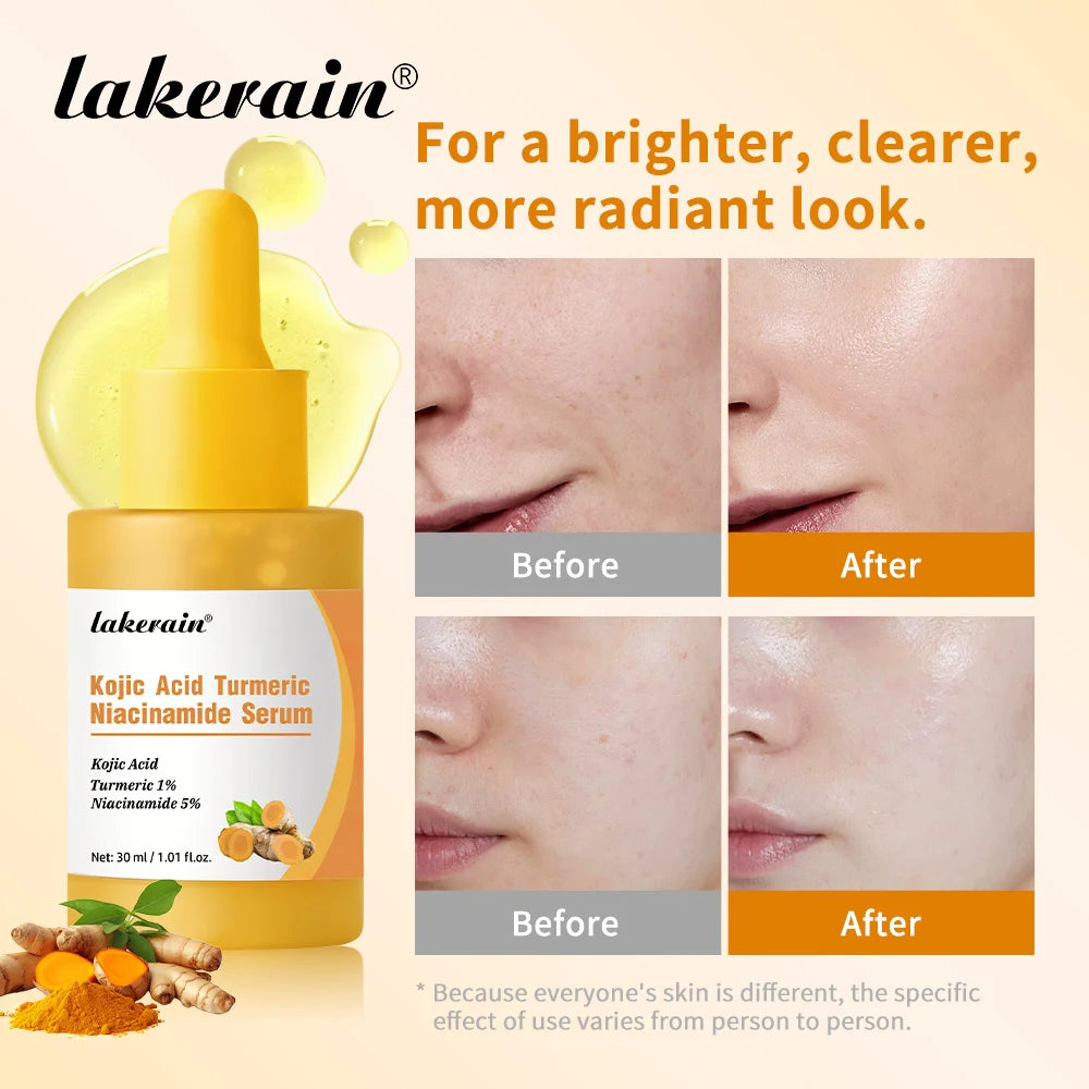 Kojic Acid Turmeric Serum Face Brightening Essence - 3