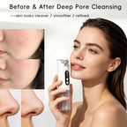 Pore Vacuum Blackhead Remover and Facial Cleansing Suction Tool