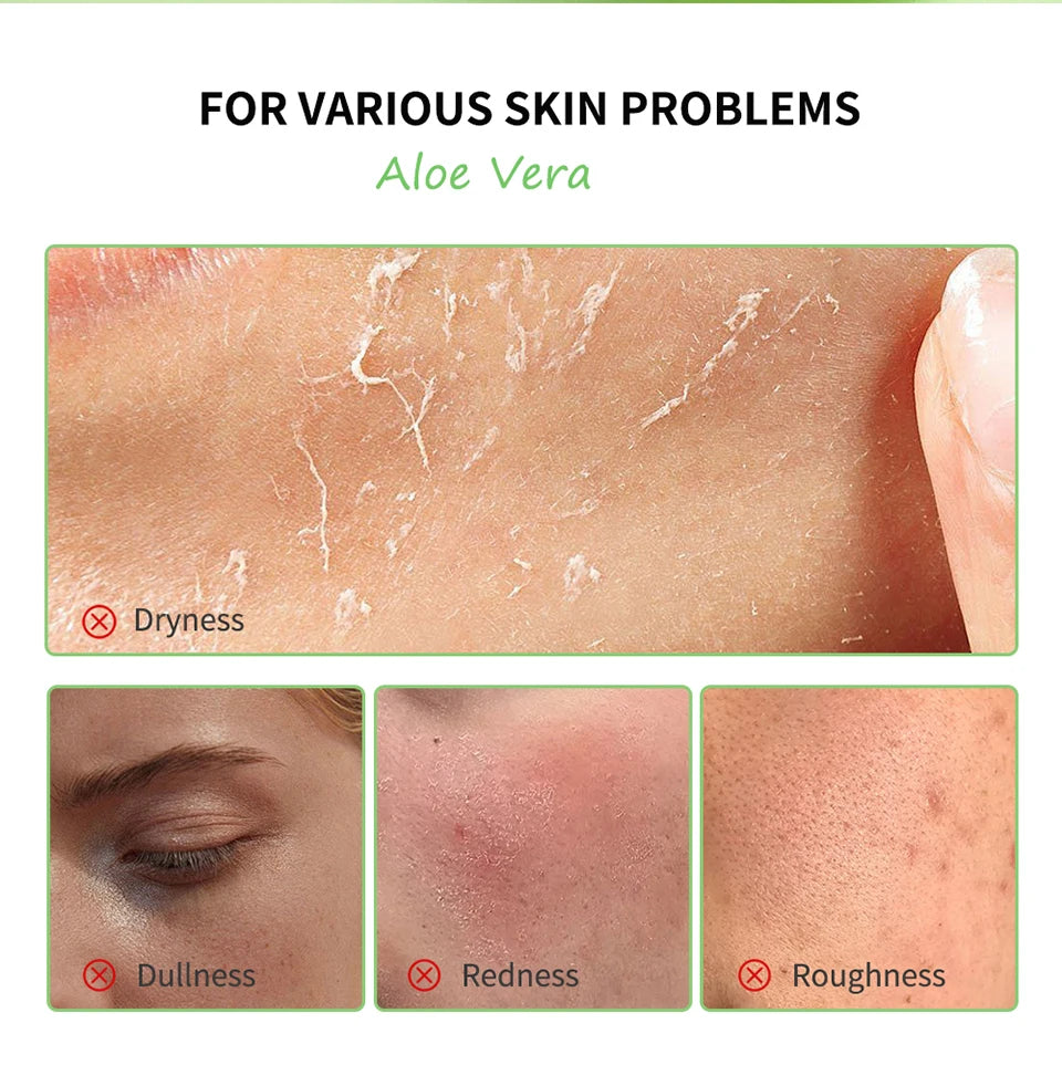 Aloe Vera Gel Moisturizing Soothing Hydrating Face Cream Skin Care - 8