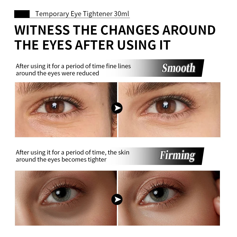 Temporary Eye Tightener Cream and Anti Aging Eye Serum