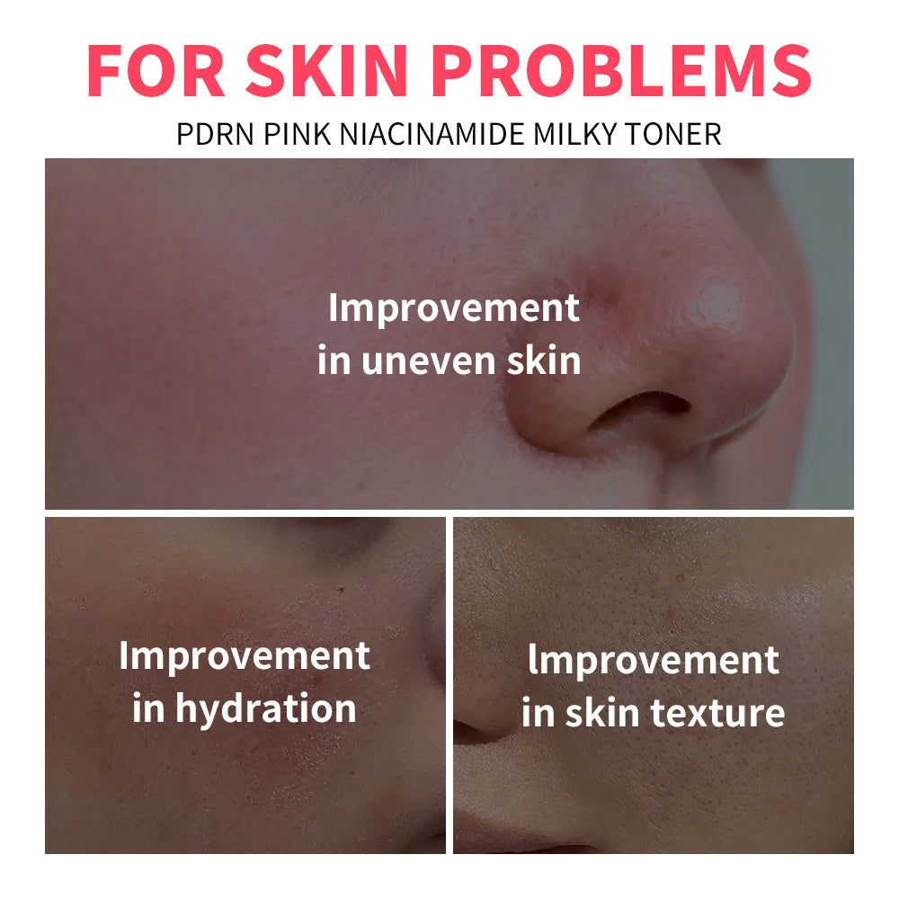 PDRN Niacinamide Toner Pink Milky Facial Moisturizer - 6