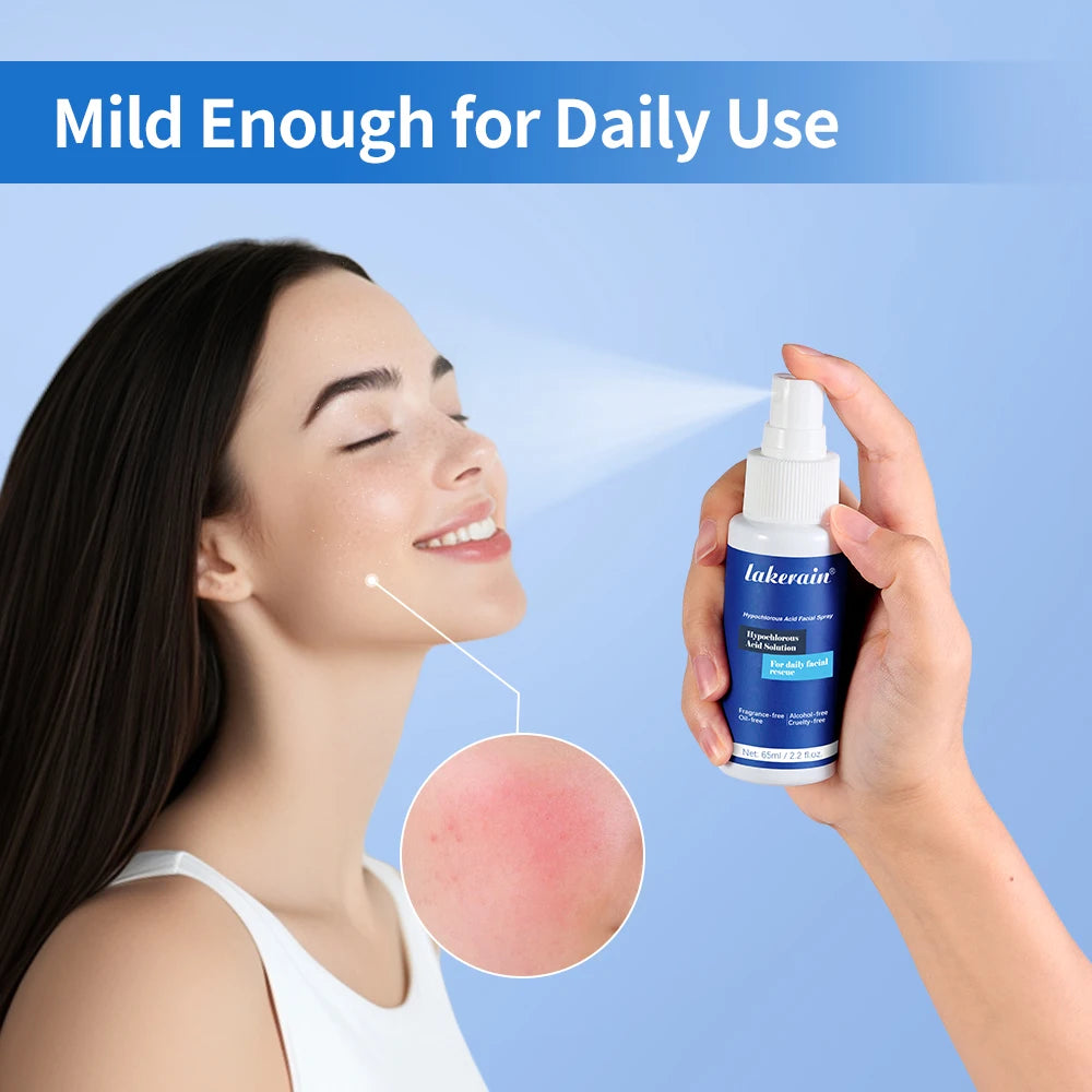 Hypochlorous Acid Facial Spray Skin Toner for Acne and Redness